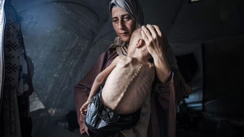 Starving children and the information war: What’s really happening in the Gaza Strip