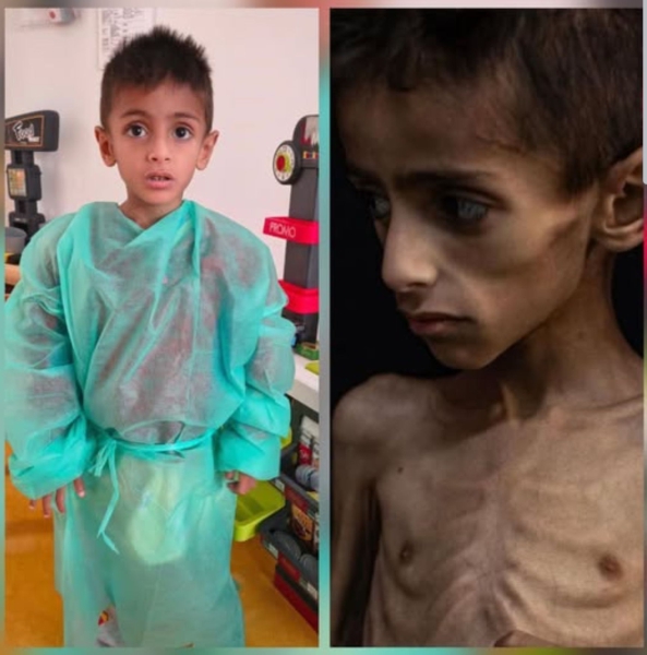 Starving children and the information war: What’s really happening in the Gaza Strip