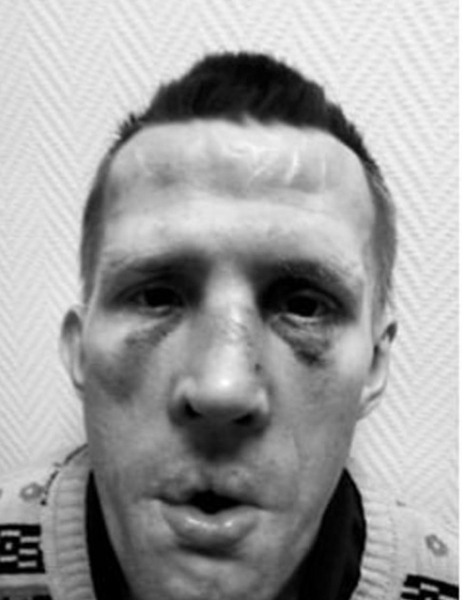 &ldquo;You walk in and see living skeletons&rdquo;: Humiliation and abuse in Russian psychiatric care homes