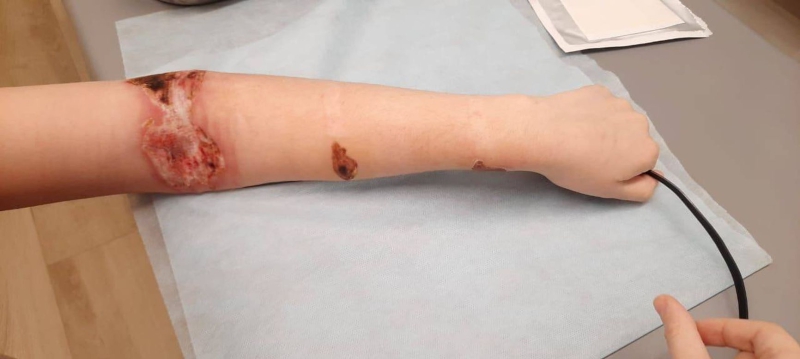 &ldquo;You walk in and see living skeletons&rdquo;: Humiliation and abuse in Russian psychiatric care homes